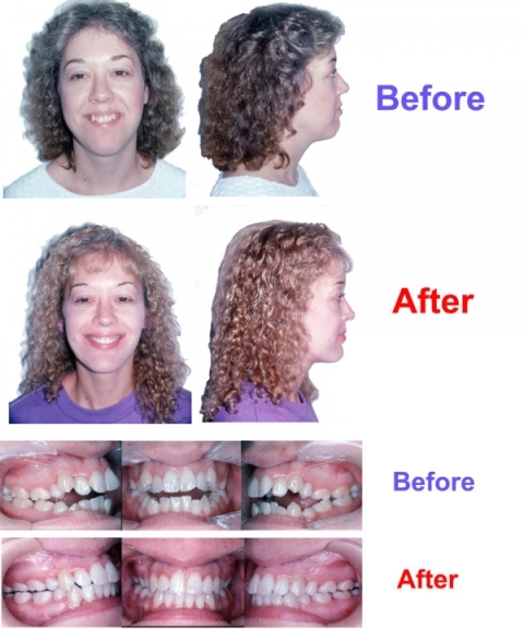 orthodontist in indianapolis in Picture Box