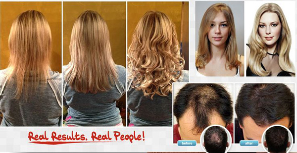 follinique.jpg5 Follinique Hair