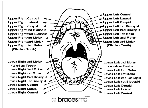 ortho dictionary Bracesinfo