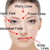 facial-muscles-and-wrinkles - Image Revive