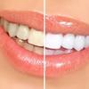 Teeth whitening product===>>http://elevategffacts.com/soleilglo/