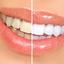 Teeth Whitening System===>>... - Teeth whitening product===>>http://elevategffacts.com/soleilglo/