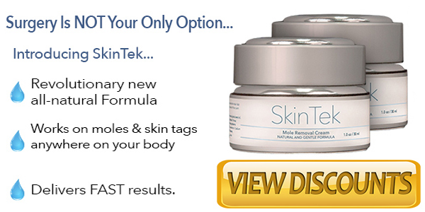 SkinTek Mole Removal: Grow Your Skin Naturally! SkinTek Mole Removal