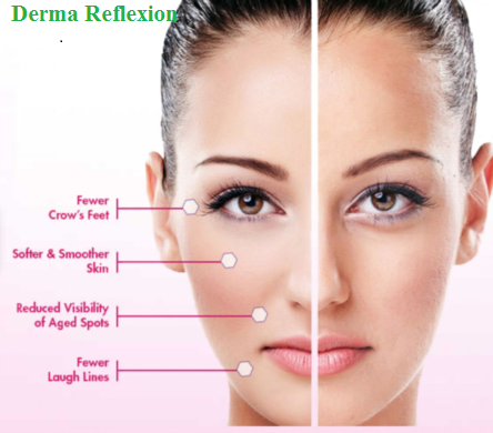 0cb22a98httphealthcareschatcomderma-reflexion-2 1 Derma Reflexion - Reduce Edema And Dark Circles around the eye area