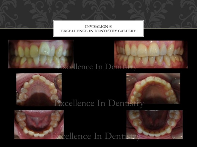 Holistic dentist Brisbane Excellence in Dentistry