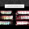 Dentist Brisbane - Excellence in Dentistry