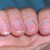 Fungaway Clear Nail Solution - Picture Box