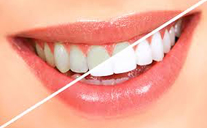 Cosmetic Dentist Mesa Dental