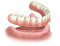 Invisalign San Diego Mesa Dental