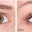 bimatoprost2 - Bimatoprost for longer lashes