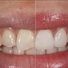 dallas cosmetic dentistry - Ambriz Center for Reconstru...