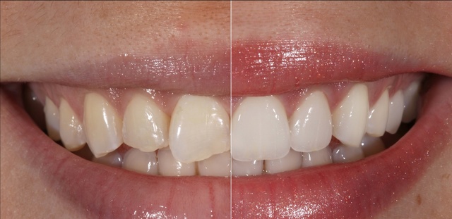 dallas cosmetic dentistry Ambriz Center for Reconstructive and Cosmetic Dentistry