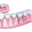 dental implants melbourne - Dentist James Peter