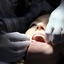 zahnreinigung-1514693 1920 - Bentleigh Dental Care