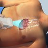 ultrasound - Queensland Diagnostic Imaging