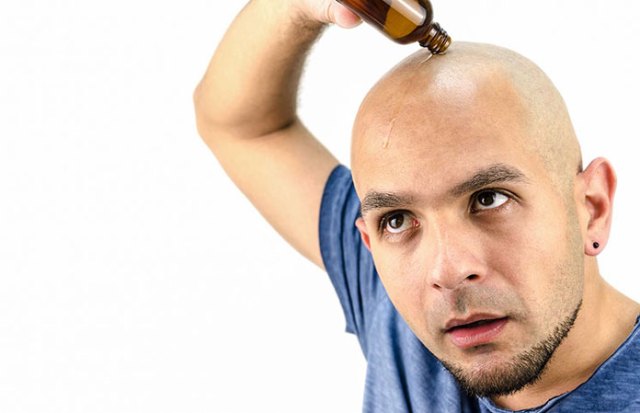 hair-growth-oil-man-bald-baldness http://www.healthitcongress.com/follicore-reviews/