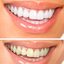 http://perfectteethpenblog - Picture Box
