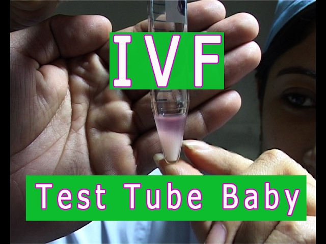Test Tube Baby in Ranchi Raipur IVF Centre