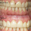 General Dentist in Anaheim ... - Dental Implants Anaheim Hills