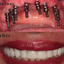Dental Implants Anaheim Hills - Dental Implants Anaheim Hills