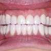 Best Implant Dentist Anahei... - Dental Implants Anaheim Hills