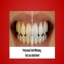 Professional teeth cleaning... - Picture Box