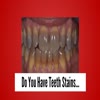 3 proven teeth stain home r... - Picture Box