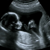 ultrasound-2 - Techo