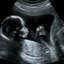 ultrasound-2 - Techo