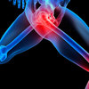 joint-pain - https://nutrasunnaturalgree...