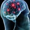 Synapse in brain homepage - http://www.tripforgoodhealth