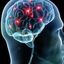 Synapse in brain homepage - http://www.tripforgoodhealth.com/focus-zx1/