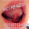 dilaltÄ± piercing - BakÄ±rkÃ¶y Piercing Ä°stanb...