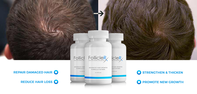 Follicle RX: Hair Increase Formula Picture Box