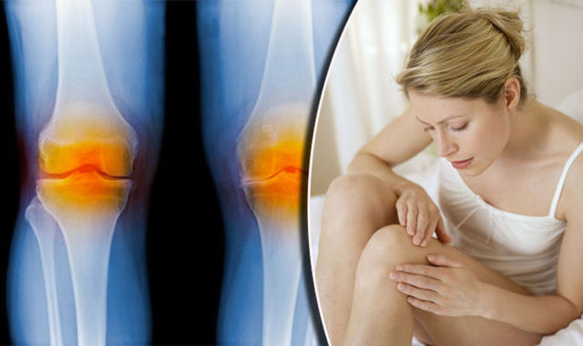 769720 - Copy Joint Cure - Reduce the Pain, Anxiety & Stress Naturally!