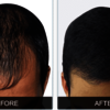 Nutralyfe Regain : Get Silky And Strong Hair