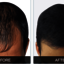 hair-regain-1 - Nutralyfe Regain : Get Silky And Strong Hair