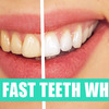 https://healthsupplementzone.com/wider-smiles-teeth-whitening/