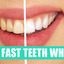 tumblr inline p6wjyzKSV91v2... - https://healthsupplementzone.com/wider-smiles-teeth-whitening/