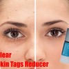 Dermaclear Pro : Reduces The Appearance Of Wrinkles & Fine Lines!
