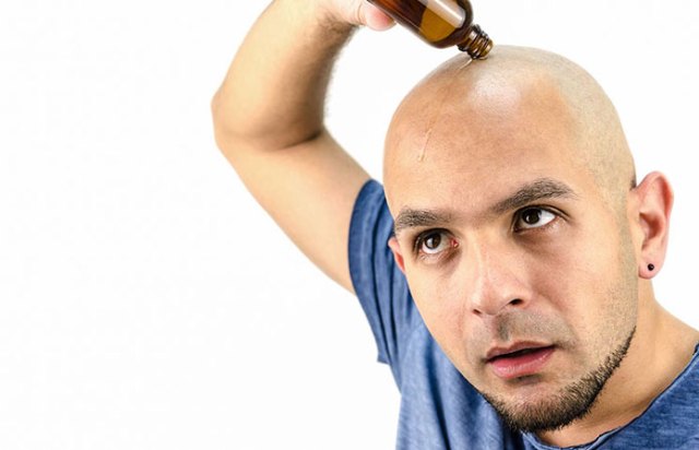 hair-growth-oil-man-bald-baldness https://realcoloncleansingworks.com/folexin/