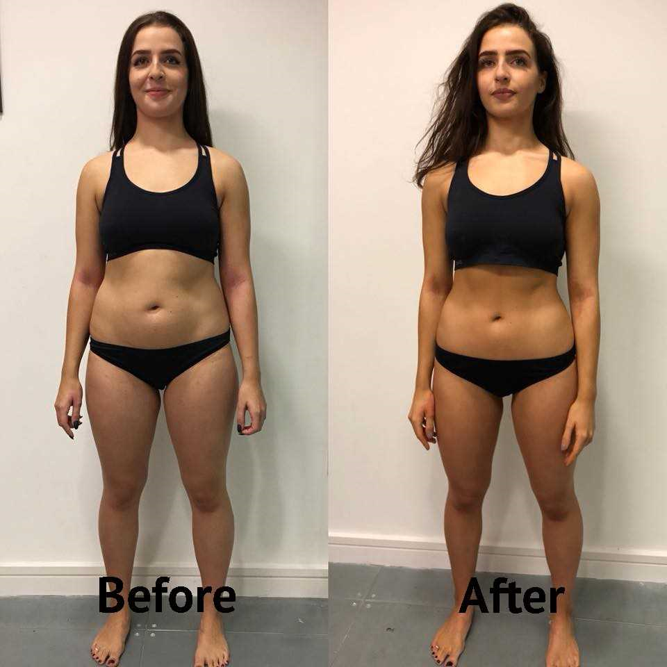 Ketofirm Picture Box