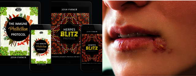 Is-There-A-Cure-for-Herpes-A-Herpes-Blitz-Protocol http://www.dealmoguls.com/herpes-blitz-protocol-reviews/
