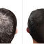 before-after3 - https://healthsupplementzone.com/shapiro-md-hair-shampoo/