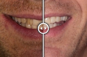 orthodontics Newnham Dental Practice