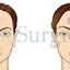 Facelift Treatments - One S... - Elite Surgical Ltd