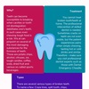 Emergency dental broken tooth - Picture Box