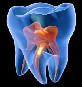 Root Canal Endodontics Greenwood Plenty Dental Care