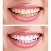 Total Radiance Teeth Whiten... - Total Radiance Teeth Whiten...