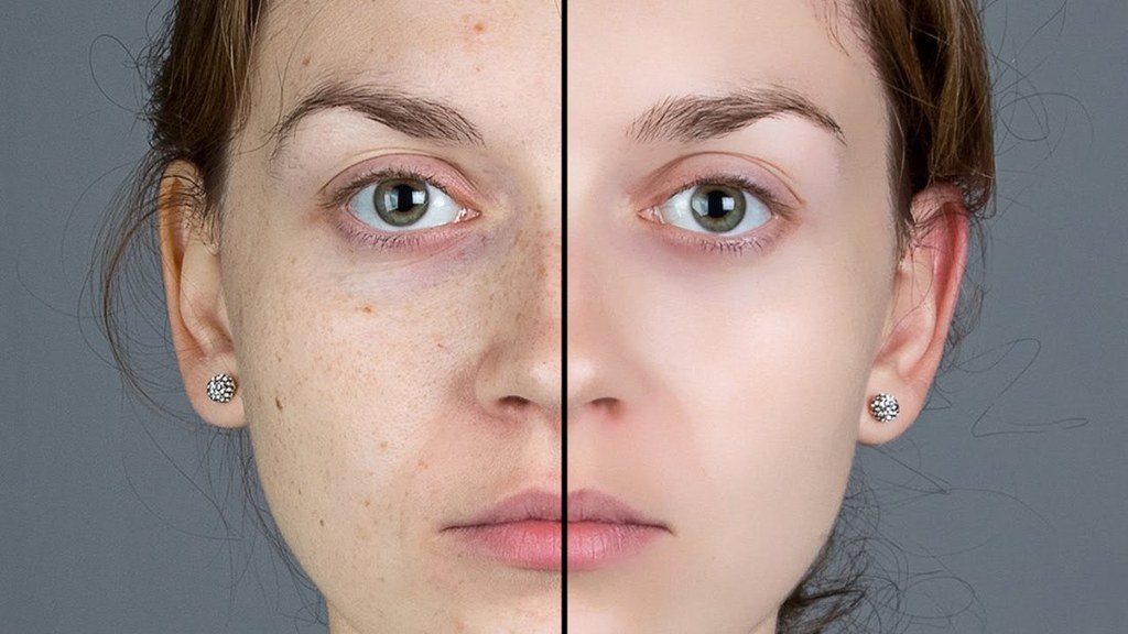 maxresdefault DermaVix Reviews